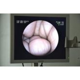COLONNA PER ENDOSCOPIA DIGESTIVA FUJINON