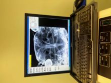 Used Cr / Dr Computed And Digital Radiography for sale. Steris ...